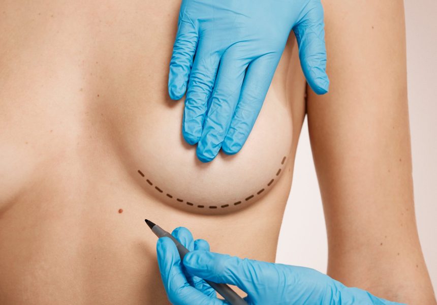 femme-balisee-pour-chirurgie-esthetique (1)