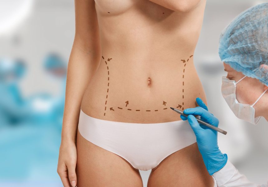 femme-balisee-pour-chirurgie-esthetique